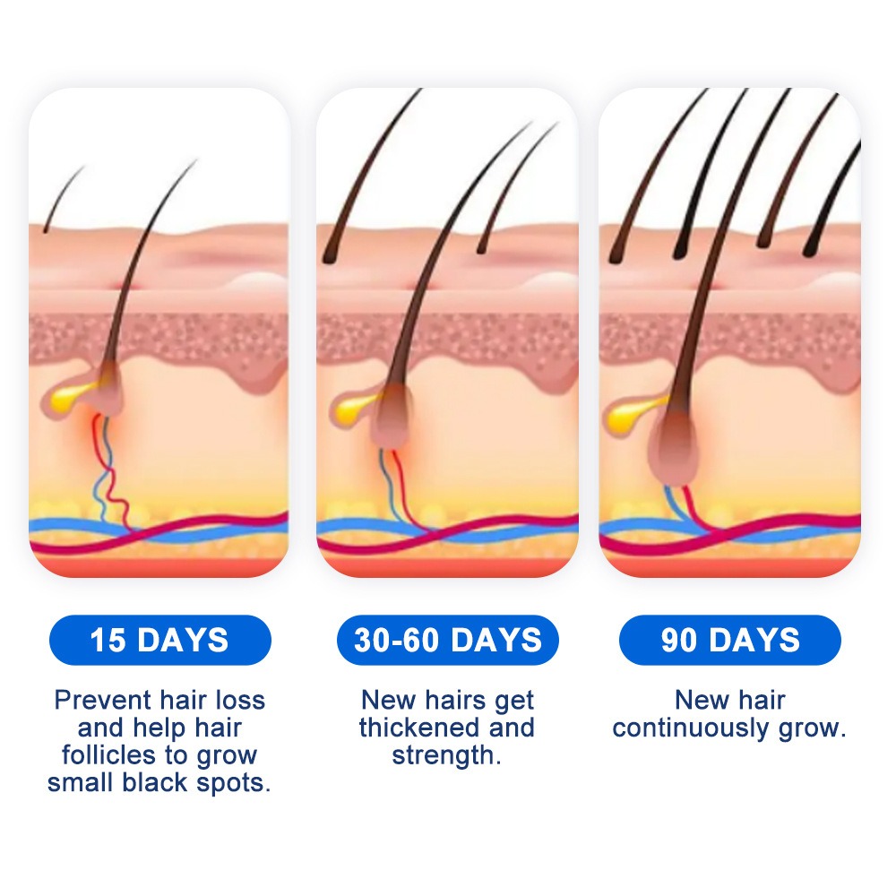 Alopecia Hair Growth Spray Sop - Hair Care Spray 评论和价格